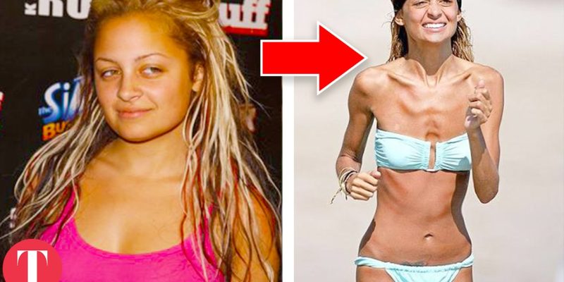 10 SHOCKING Weight Changes Of Famous People