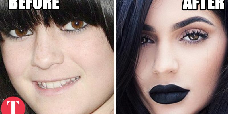 10 Famous People Who Have Admitted To Plastic Surgery