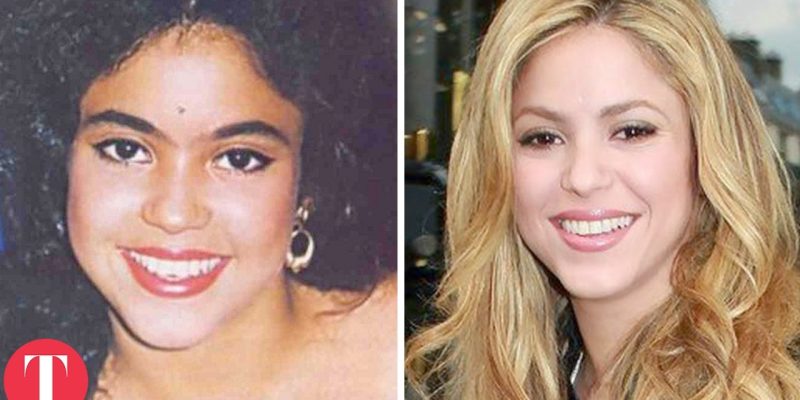 10 Hot Celebs Who Used To Be Ugly Ducklings