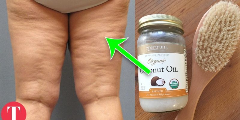 10 Weird Ways You Can Get Rid Of Cellulite