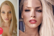 10 Hot Instagram Stars Before Plastic Surgery