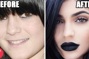 10 Famous People Who Have Admitted To Plastic Surgery