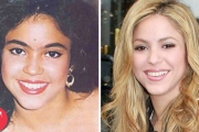 10 Hot Celebs Who Used To Be Ugly Ducklings