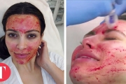 10 Most Shocking Beauty Treatments