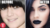 10 Famous People Who Have Admitted To Plastic Surgery